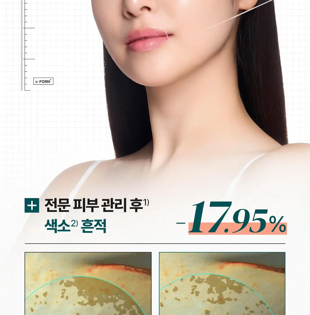 [흔적 리페어_c-PDRN 10,000 PPM]리쥬덱스 더마 리페어링 솔루션 앰플 10mLx2EA 상세페이지 8